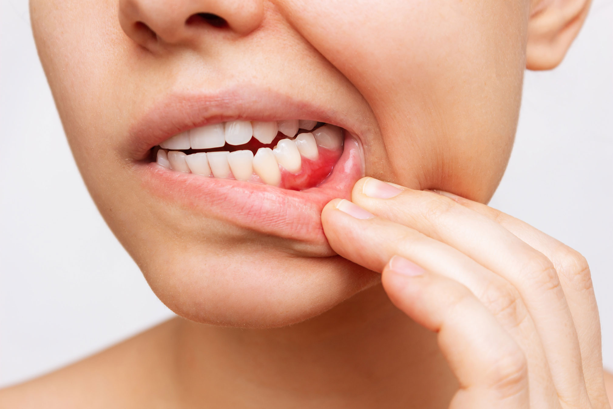 https://www.expressionsdental.co.uk/wp-content/uploads/2022/09/periodontal-disease.jpg